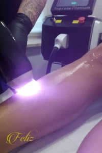 depilacja laserowa łydek w gabinecie kosmetycznym